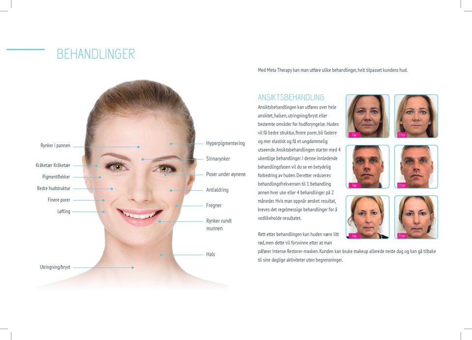ANSIKTSBEHANDLING Ansiktsbehandlingen kan utføres over hele ansiktet, halsen, utringning/bryst eller bestemte områder for hudforyngelse.