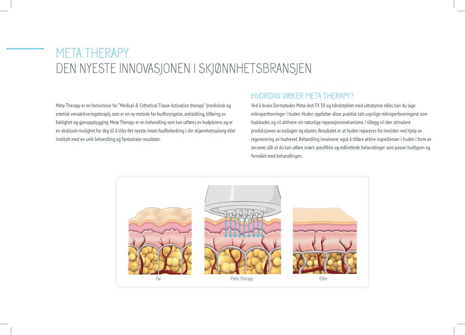 Meta Therapy er en behandling som kan utføres av hudpleiere, og er en eksklusiv mulighet for deg til å tilby det nyeste innen hudforbedring i din skjønnhetssalong eller institutt med en unik