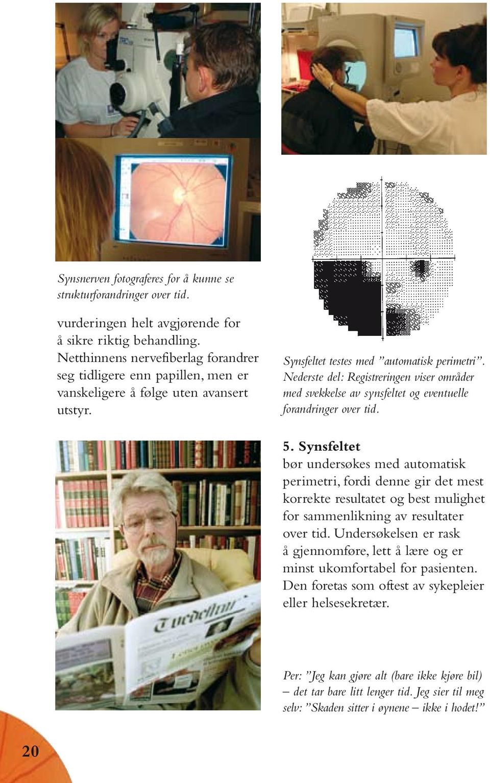 Nederste del: Registreringen viser områder med svekkelse av synsfeltet og eventuelle forandringer over tid. 5.