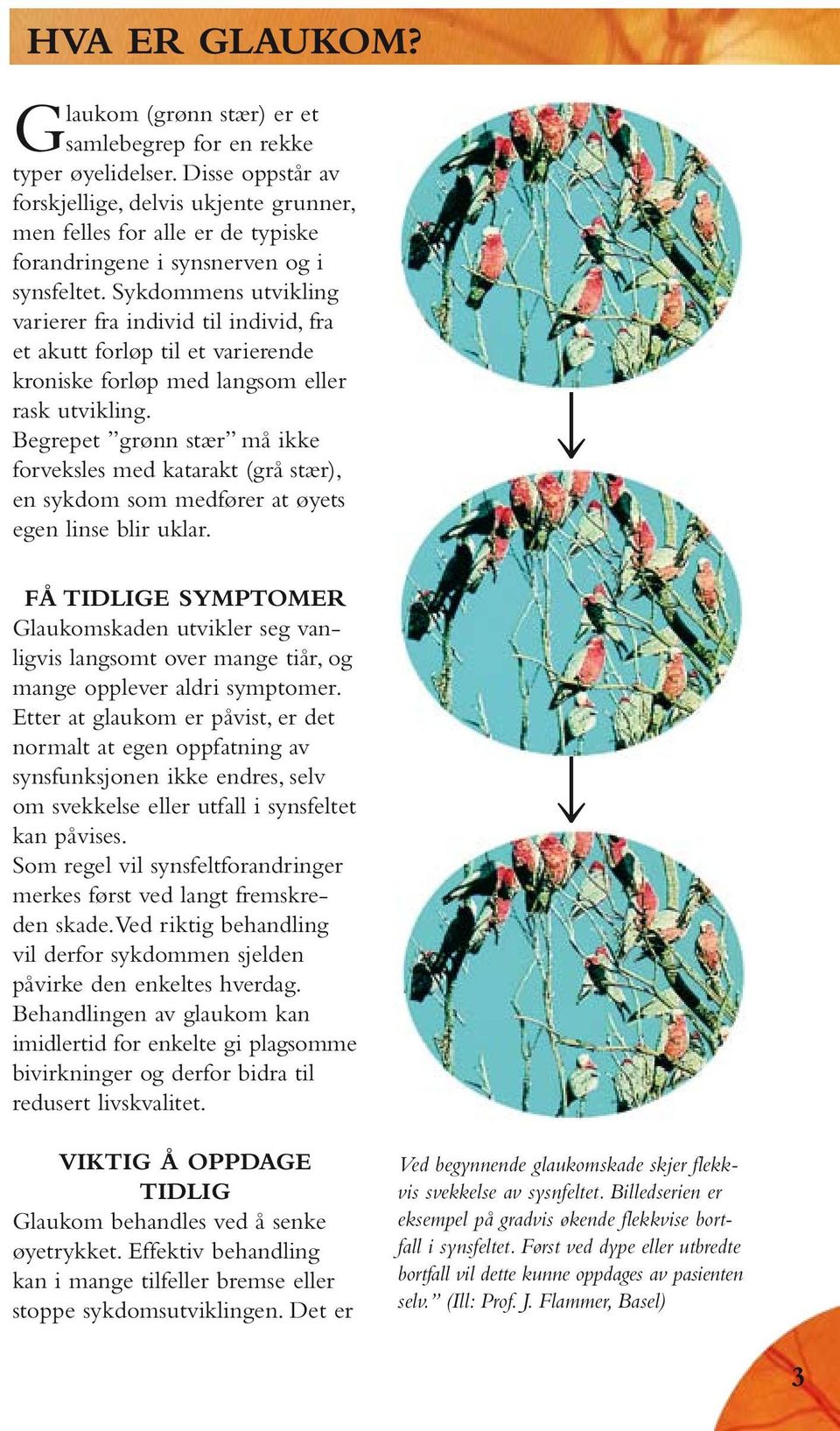 Sykdommens utvikling varierer fra individ til individ, fra et akutt forløp til et varierende kroniske forløp med langsom eller rask utvikling.