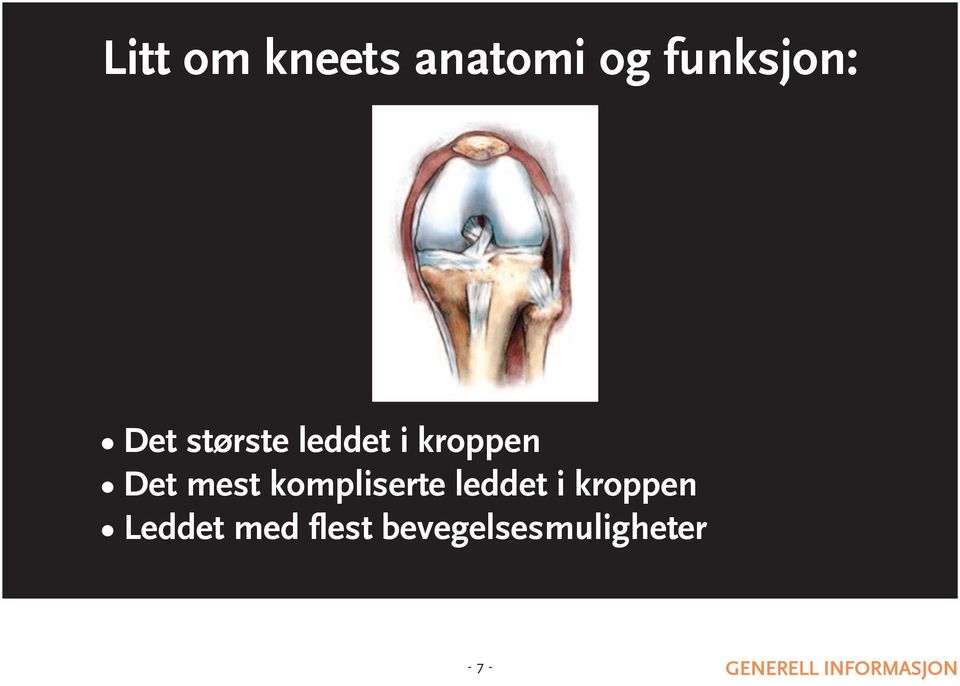 kompliserte leddet i kroppen Leddet med