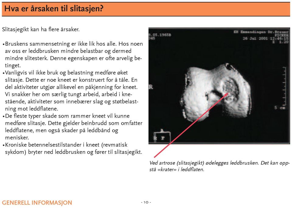 en del aktiviteter utgjør allikevel en påkjenning for kneet. Vi snakker her om særlig tungt arbeid, arbeid i knestående, aktiviteter som innebærer slag og støtbelastning mot leddflatene.