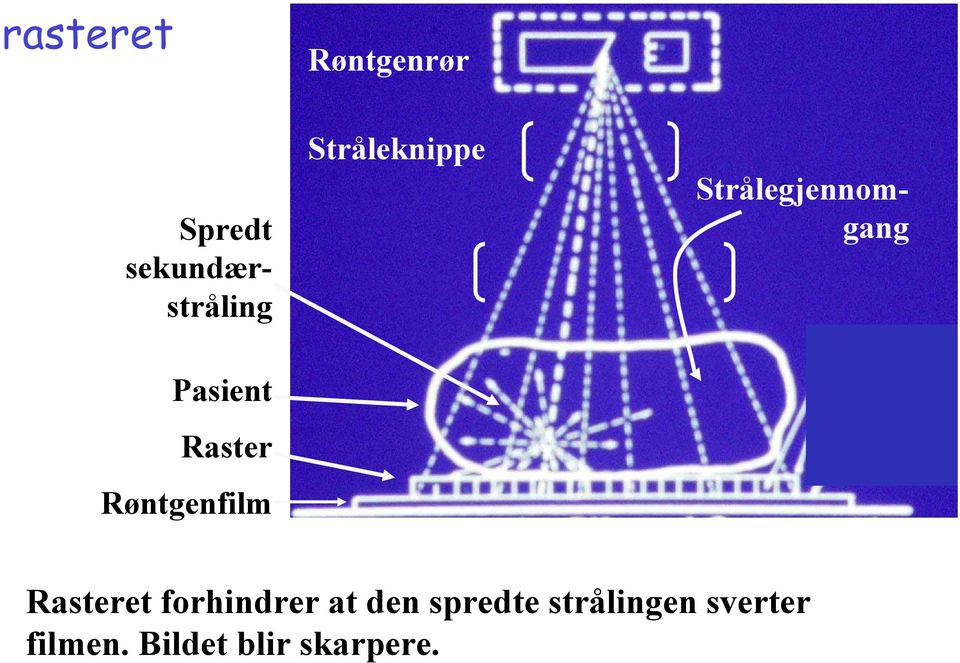 Strålegjennomgang Rasteret forhindrer at den