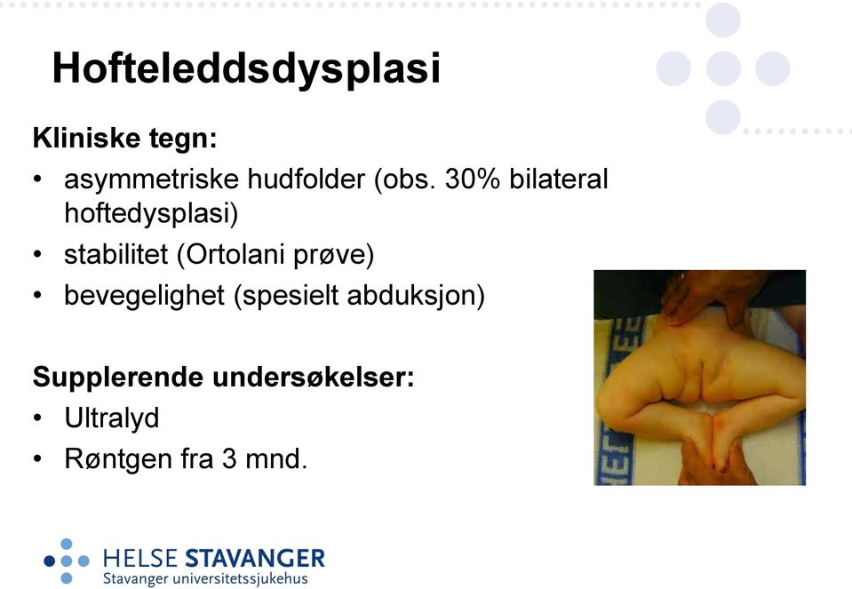 30% bilateral hoftedysplasi) stabilitet (Ortolani