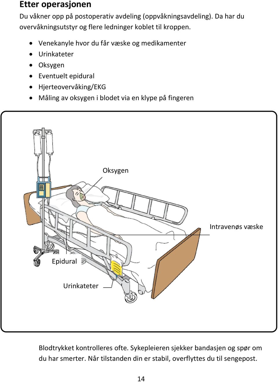 Venekanyle hvor du får væske og medikamenter Urinkateter Oksygen Eventuelt epidural Hjerteovervåking/EKG Måling av oksygen i