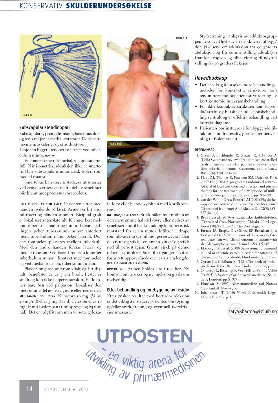 figur 10 Subscapularistendinopati Subscapularis, pectoralis major, latissimus dorsi og teres major er medial-rotatorer. De siste tre nevnte muskeler er også adduktorer.