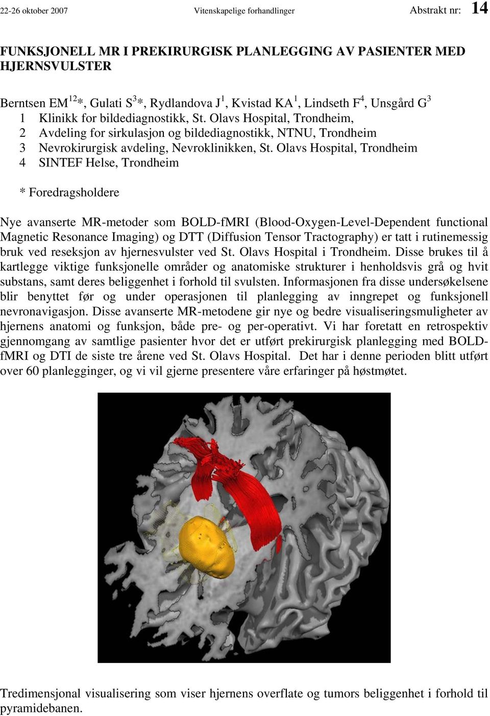 Olavs Hospital, Trondheim 4 SINTEF Helse, Trondheim * Foredragsholdere Nye avanserte MR-metoder som BOLD-fMRI (Blood-Oxygen-Level-Dependent functional Magnetic Resonance Imaging) og DTT (Diffusion