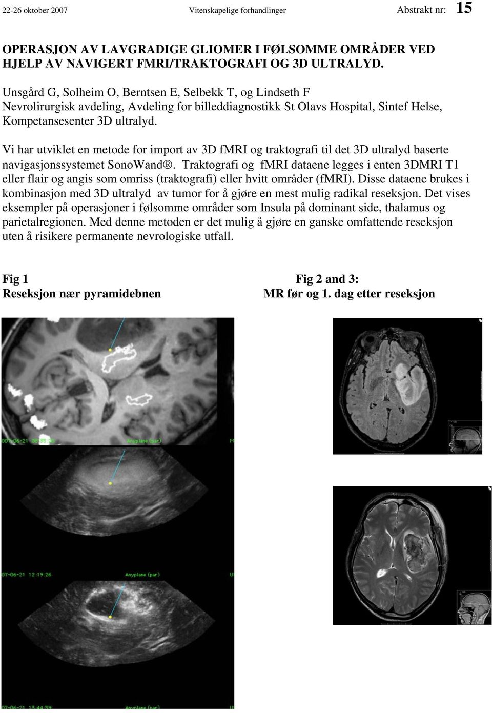 Vi har utviklet en metode for import av 3D fmri og traktografi til det 3D ultralyd baserte navigasjonssystemet SonoWand.