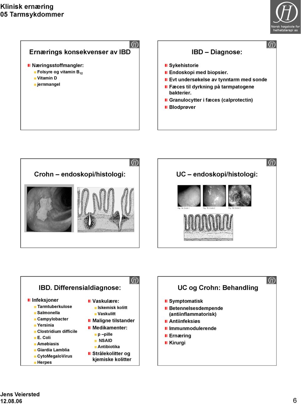 Differensialdiagnose: UC og Crohn: Behandling Infeksjoner Tarmtuberkulose Salmonella Campylobacter Yersinia Clostridium difficile E.