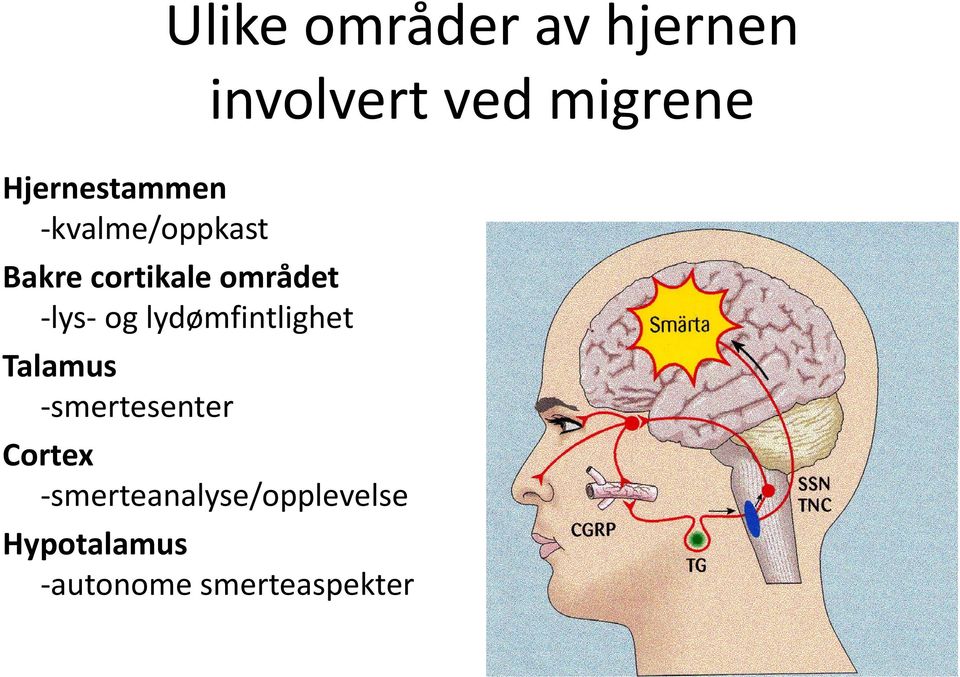 lys og lydømfintlighet Talamus smertesenter Cortex