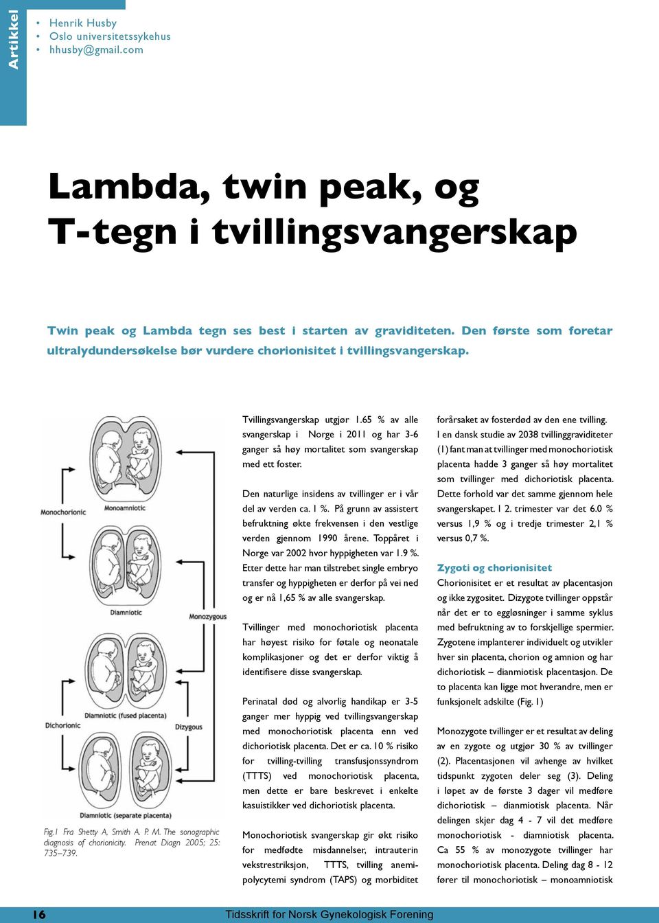 Prenat Diagn 2005; 25: 735 739. Tvillingsvangerskap utgjør 1.65 % av alle svangerskap i Norge i 2011 og har 3-6 ganger så høy mortalitet som svangerskap med ett foster.