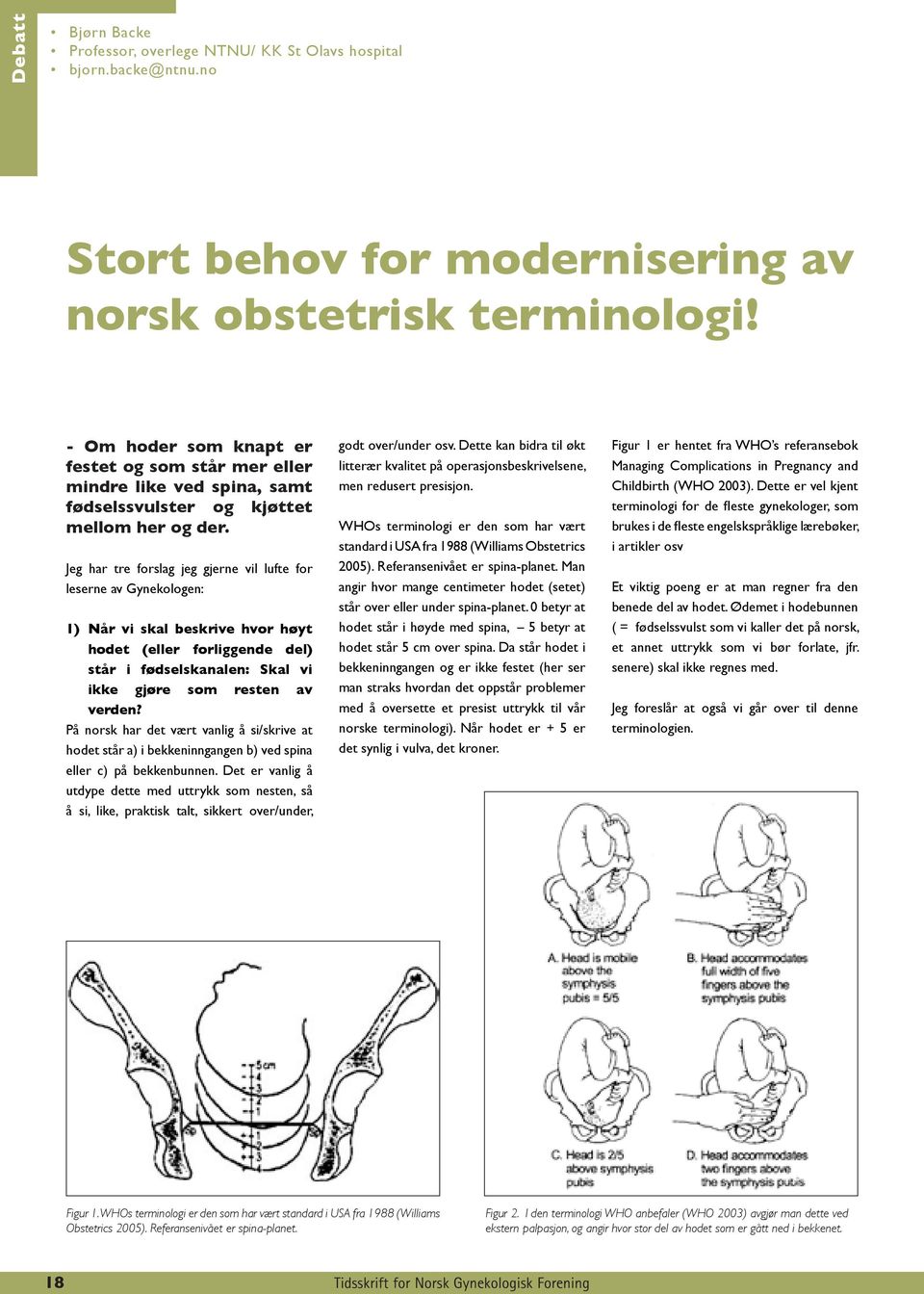 Jeg har tre forslag jeg gjerne vil lufte for leserne av Gynekologen: 1) Når vi skal beskrive hvor høyt hodet (eller forliggende del) står i fødselskanalen: Skal vi ikke gjøre som resten av verden?