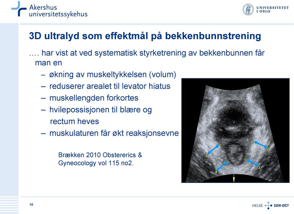 muskeltykkelsen (volum) reduserer arealet til levator hiatus muskellengden forkortes