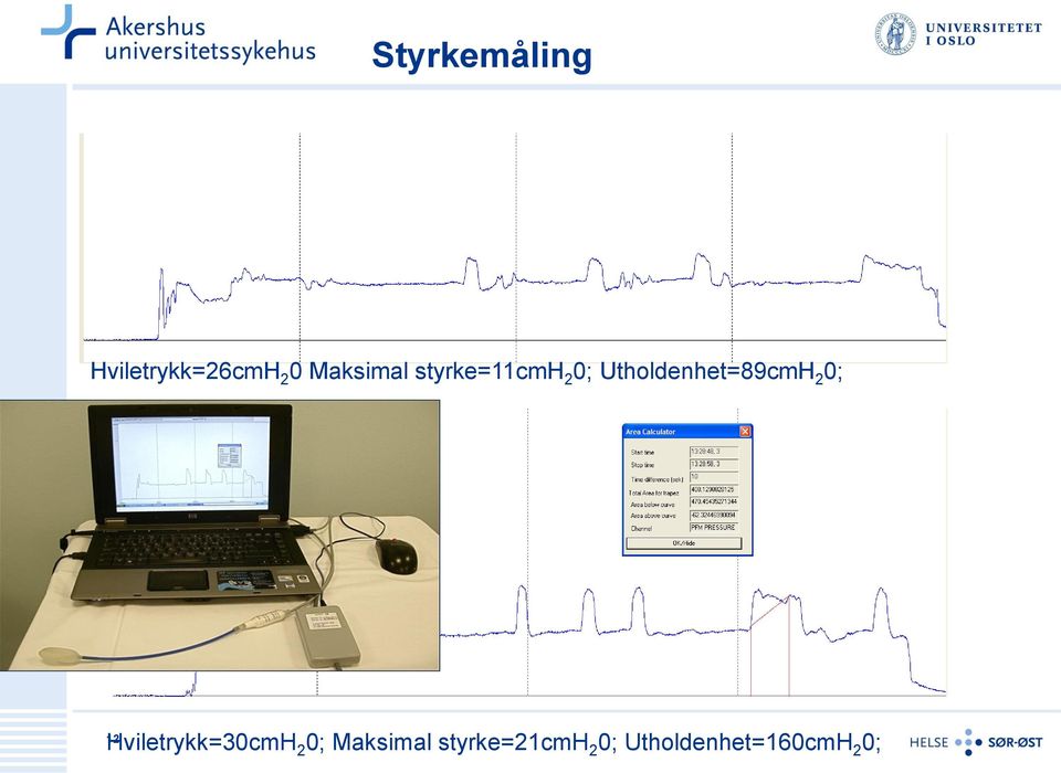 Utholdenhet=89cmH 2 0; 12