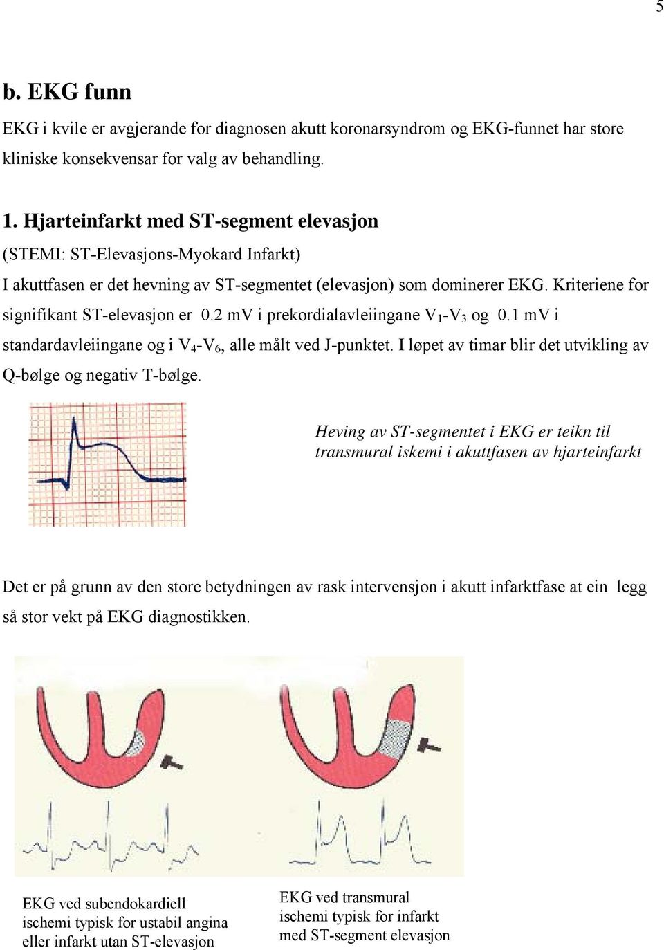 2 mv i prekordialavleiingane V 1 -V 3 og 0.1 mv i standardavleiingane og i V 4 -V 6, alle målt ved J-punktet. I løpet av timar blir det utvikling av Q-bølge og negativ T-bølge.