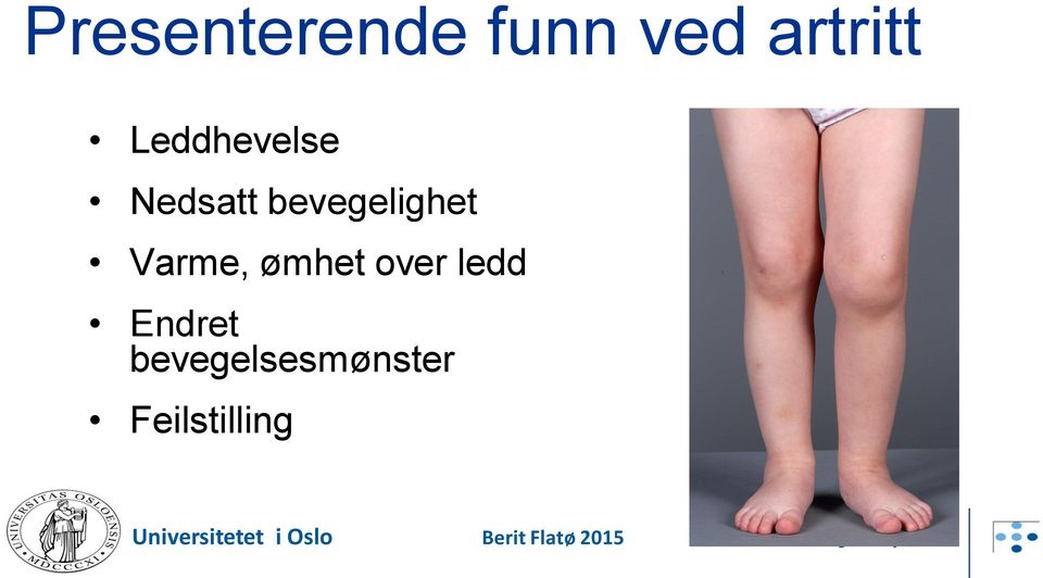 bevegelighet Varme, ømhet over