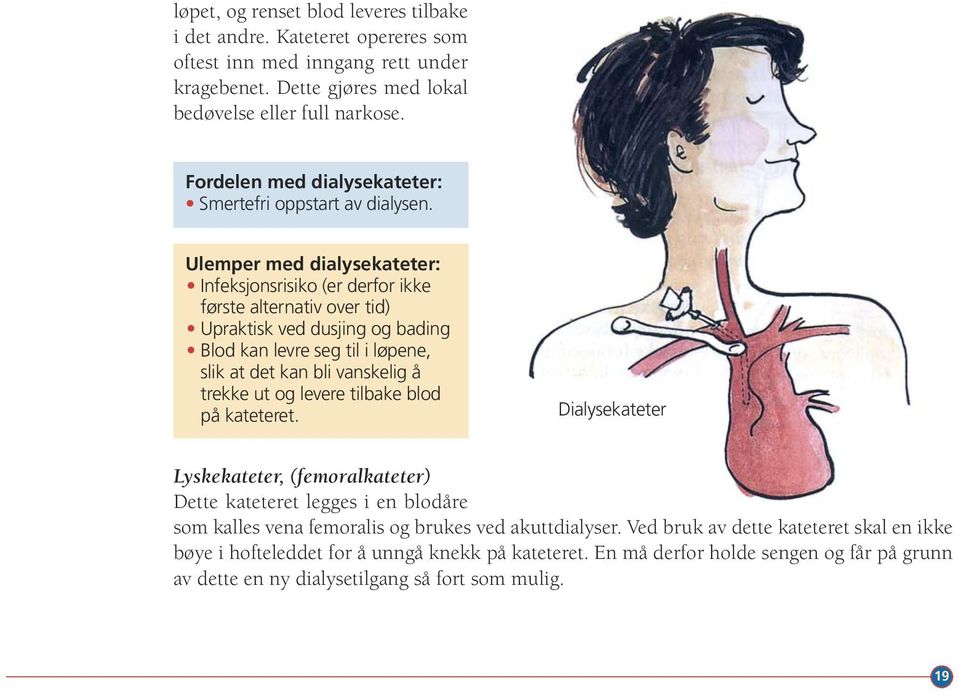 Ulemper med dialysekateter: Infeksjonsrisiko (er derfor ikke første alternativ over tid) Upraktisk ved dusjing og bading Blod kan levre seg til i løpene, slik at det kan bli vanskelig å trekke ut