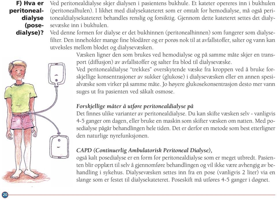 Ved denne formen for dialyse er det bukhinnen (peritonealhinnen) som fungerer som dialysefilter.