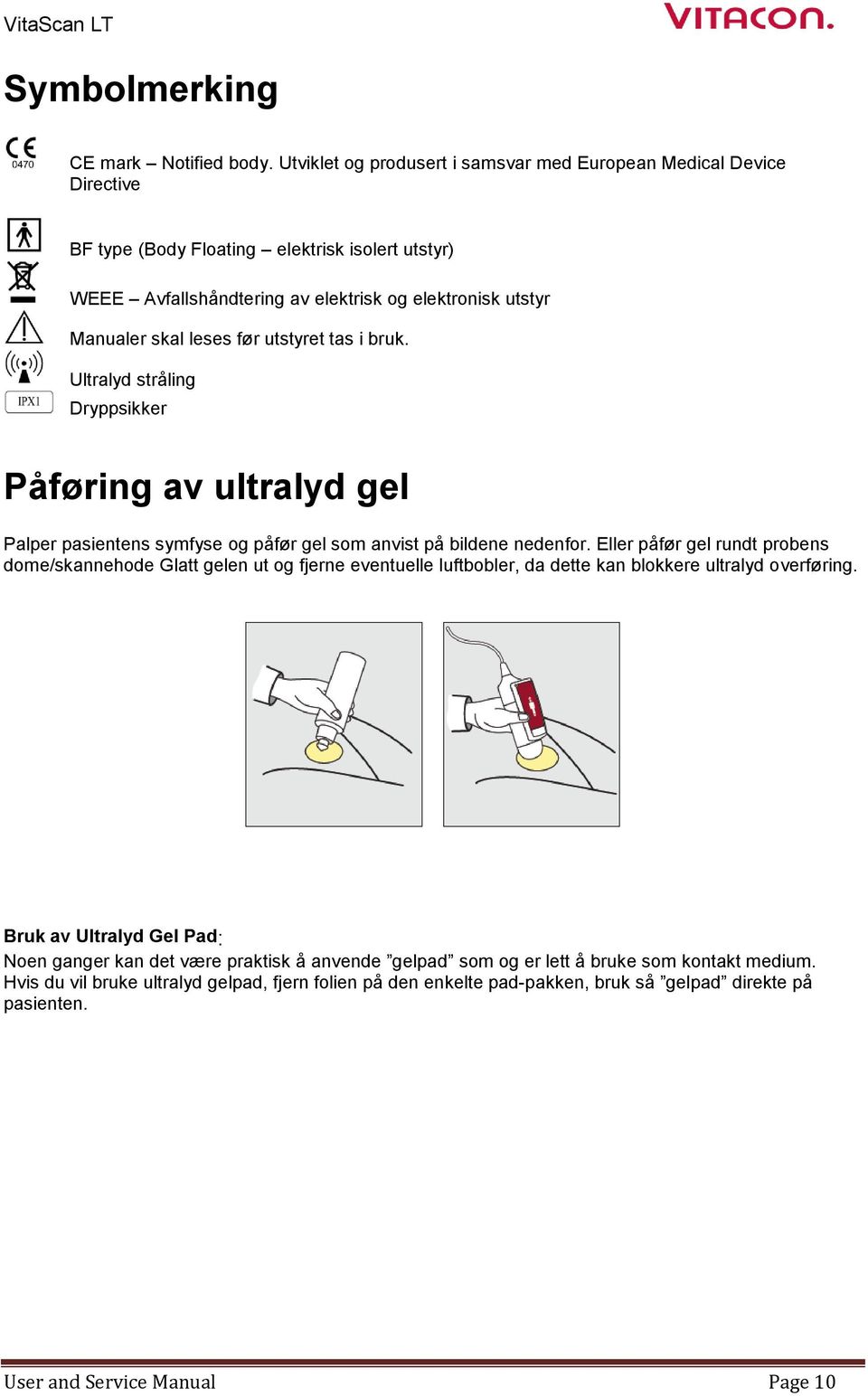 før utstyret tas i bruk. Ultralyd stråling Dryppsikker Påføring av ultralyd gel Palper pasientens symfyse og påfør gel som anvist på bildene nedenfor.