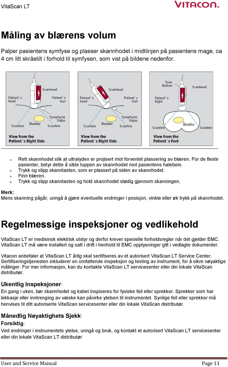 Trykk og slipp skanntasten, som er plassert på siden av skannhodet. Finn blæren. Trykk og slipp skanntasten og hold skannhodet stødig gjennom skanningen.