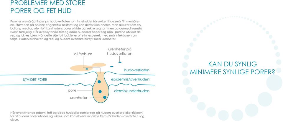 Når overskytende fett og døde hudceller hoper seg opp i porene utvider de seg og lukkes igjen. Når dette skjer blir bakterier ofte innesperret, med små infeksjoner som følge.