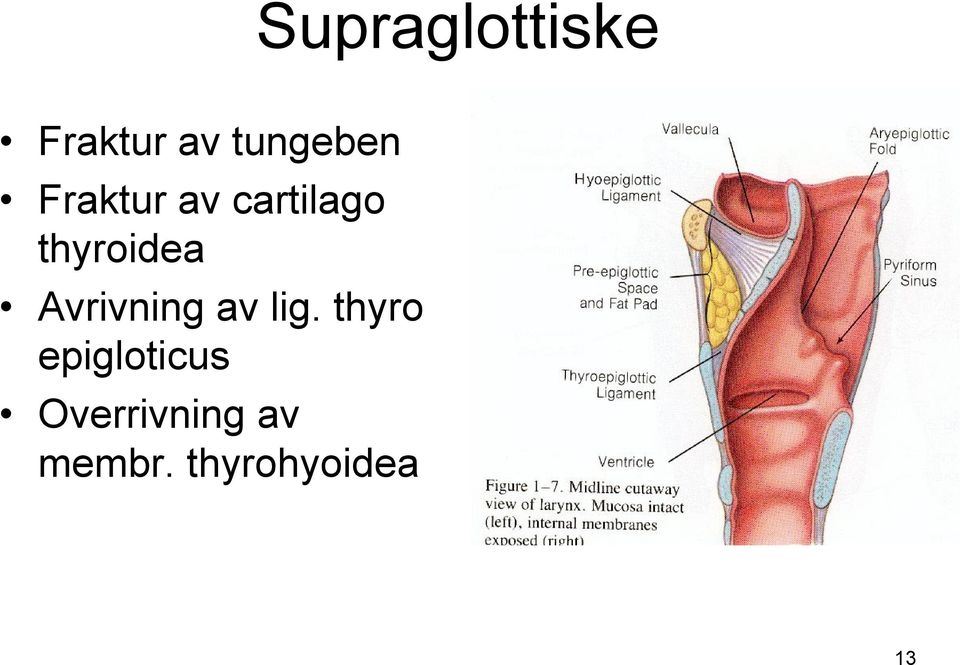 Avrivning av lig.