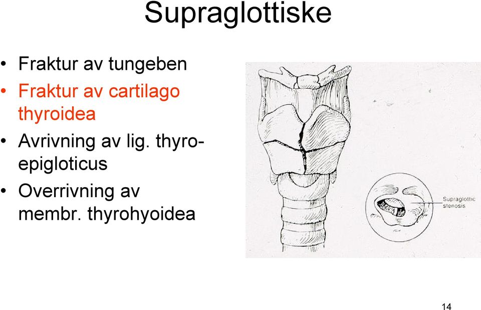 Avrivning av lig.