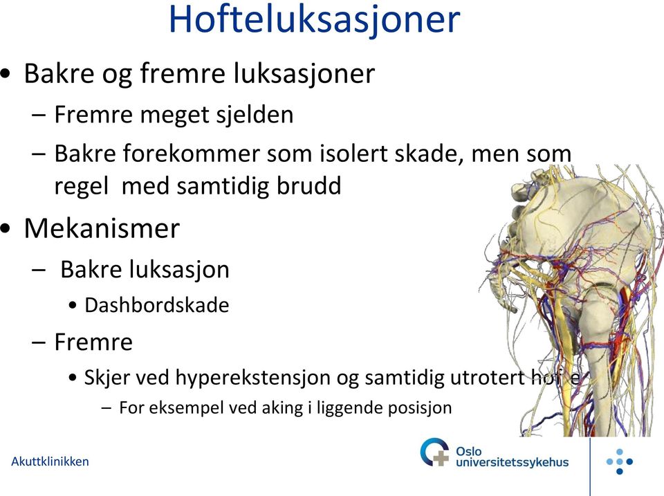 Mekanismer Bakre luksasjon Dashbordskade Fremre Skjer ved