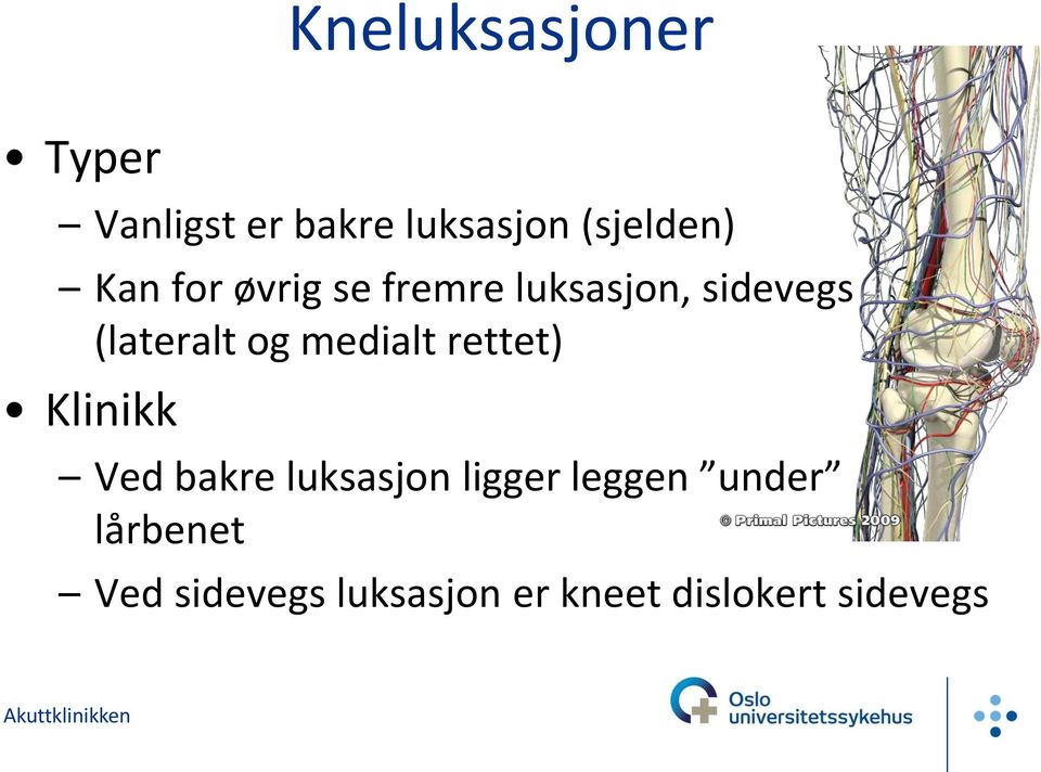 medialt rettet) Klinikk Ved bakre luksasjon ligger leggen