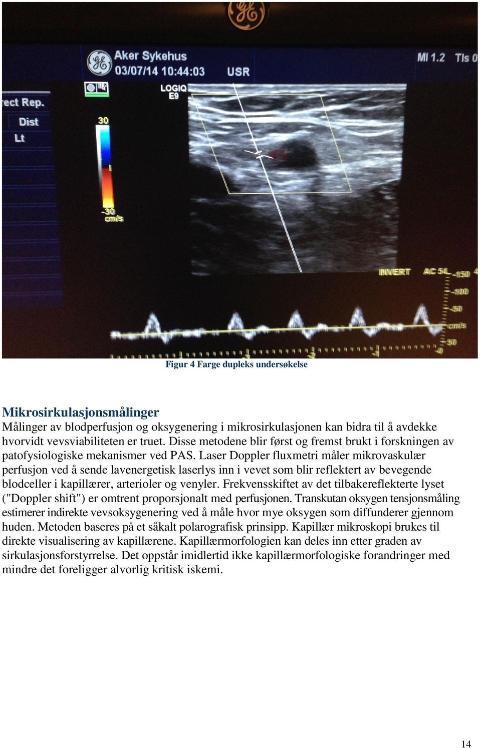 Laser Doppler fluxmetri måler mikrovaskulær perfusjon ved å sende lavenergetisk laserlys inn i vevet som blir reflektert av bevegende blodceller i kapillærer, arterioler og venyler.