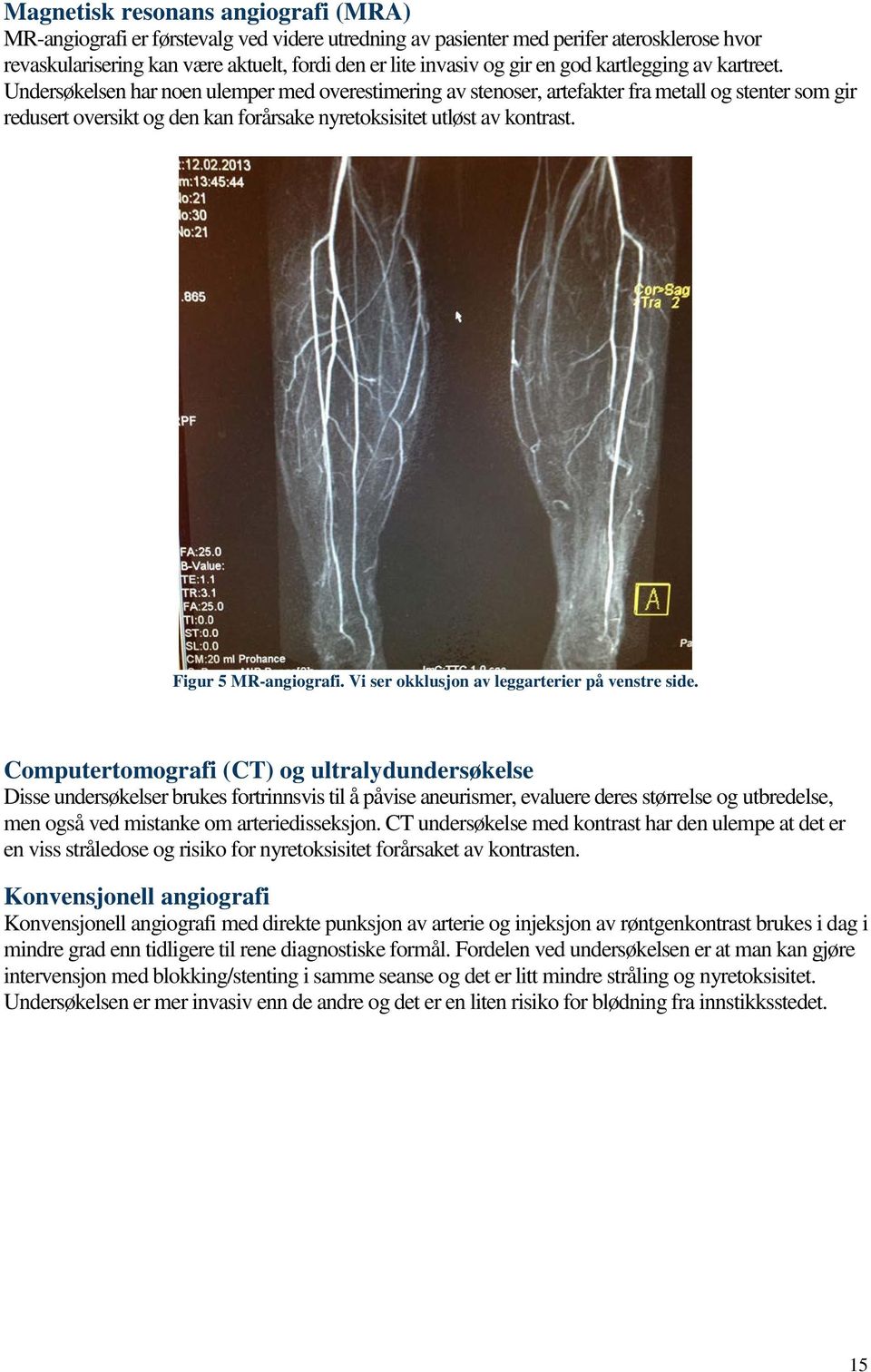 Undersøkelsen har noen ulemper med overestimering av stenoser, artefakter fra metall og stenter som gir redusert oversikt og den kan forårsake nyretoksisitet utløst av kontrast. Figur 5 MR-angiografi.