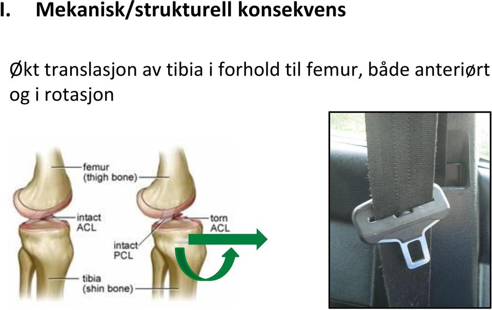 av tibia i forhold til