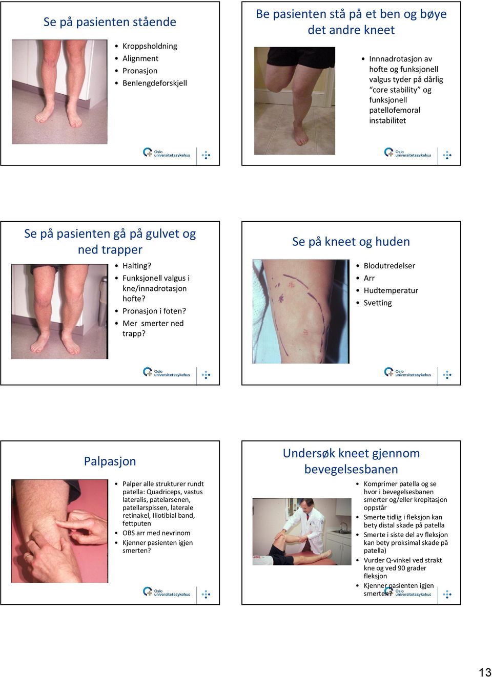 Se påkneet og huden Blodutredelser Arr Hudtemperatur Svetting Palpasjon Palper alle strukturer rundt patella: Quadriceps, vastus lateralis, patelarsenen, patellarspissen, laterale retinakel,