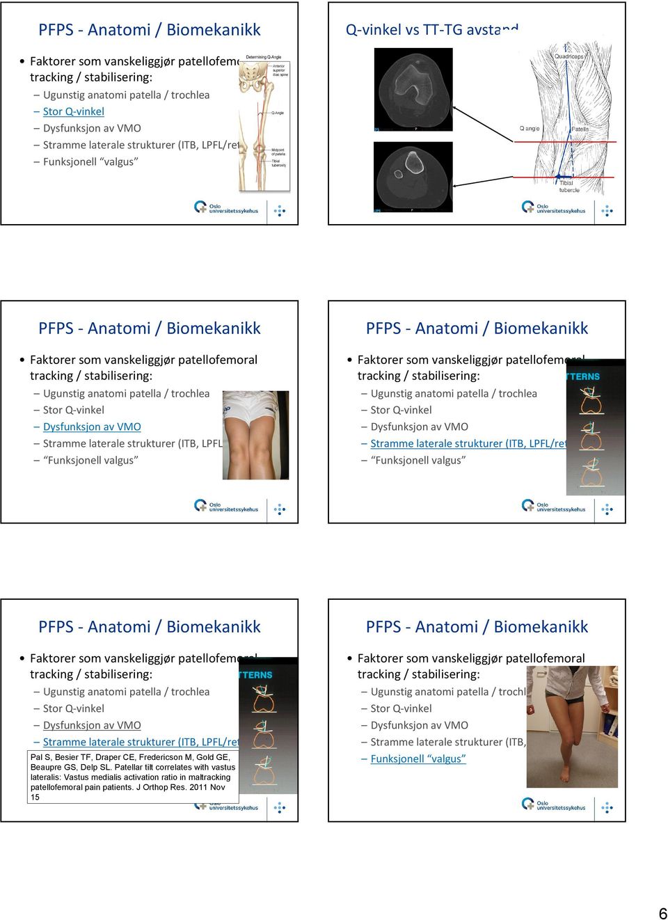 SL. Patellar tilt correlates with vastus lateralis: Vastus medialis activation ratio