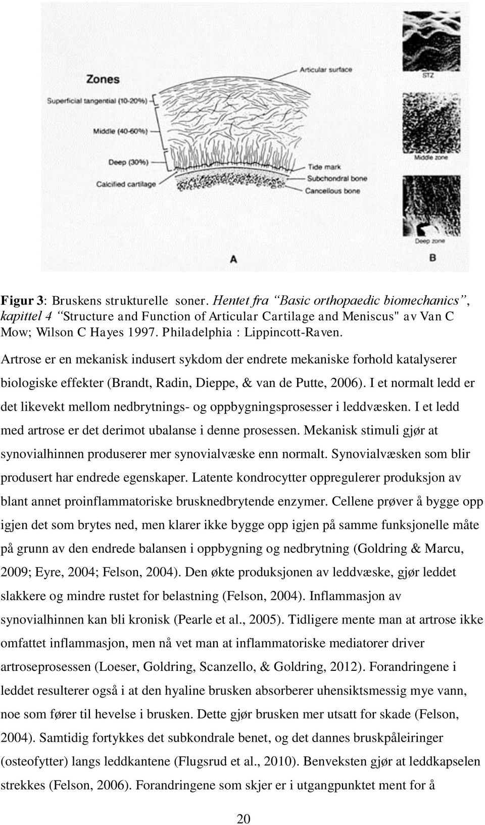 I et normalt ledd er det likevekt mellom nedbrytnings- og oppbygningsprosesser i leddvæsken. I et ledd med artrose er det derimot ubalanse i denne prosessen.