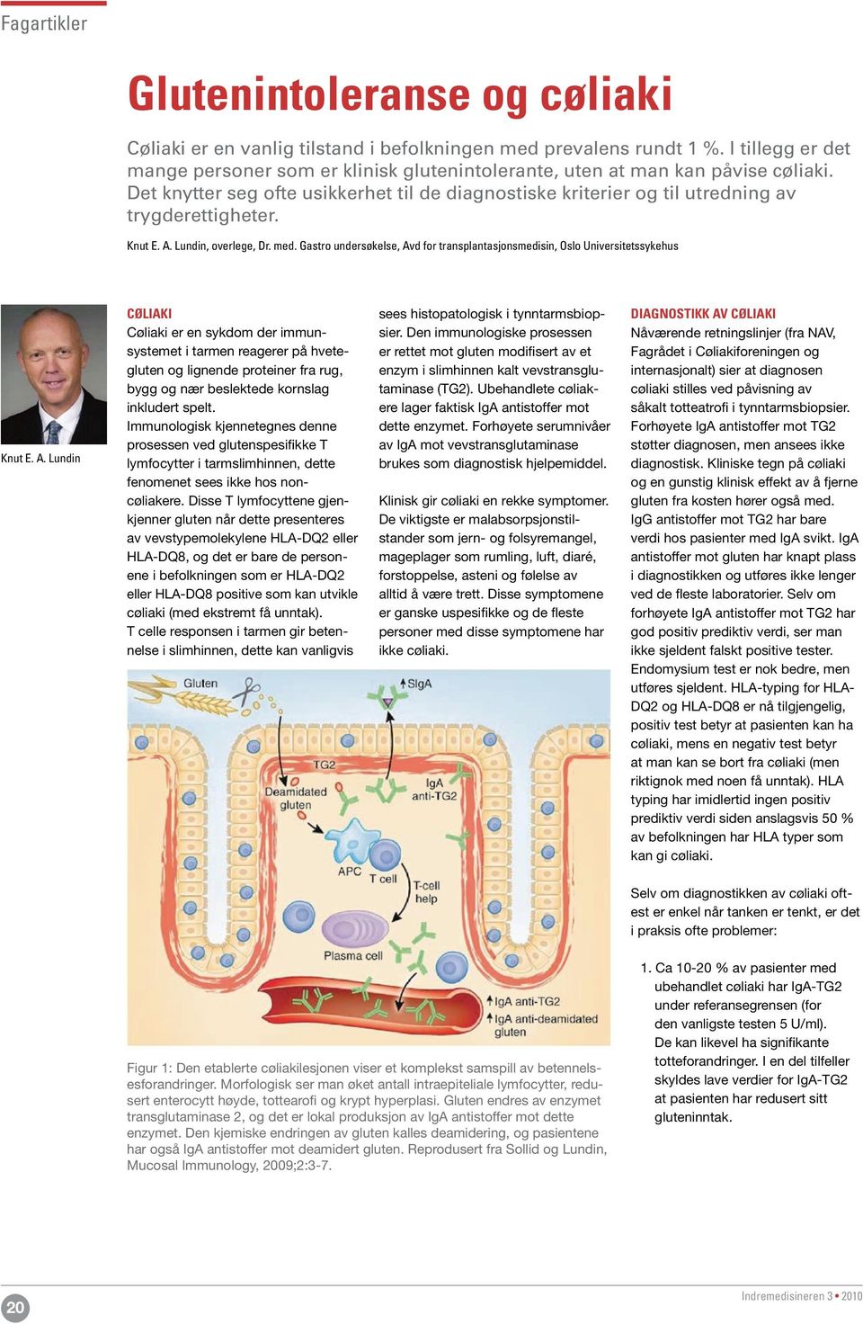 Knut E. A. Lundin, overlege, Dr. med. Gastro undersøkelse, Avd for transplantasjonsmedisin, Oslo Universitetssykehus Knut E. A. Lundin CØLIAKI Cøliaki er en sykdom der immunsystemet i tarmen reagerer på hvetegluten og lignende proteiner fra rug, bygg og nær beslektede kornslag inkludert spelt.