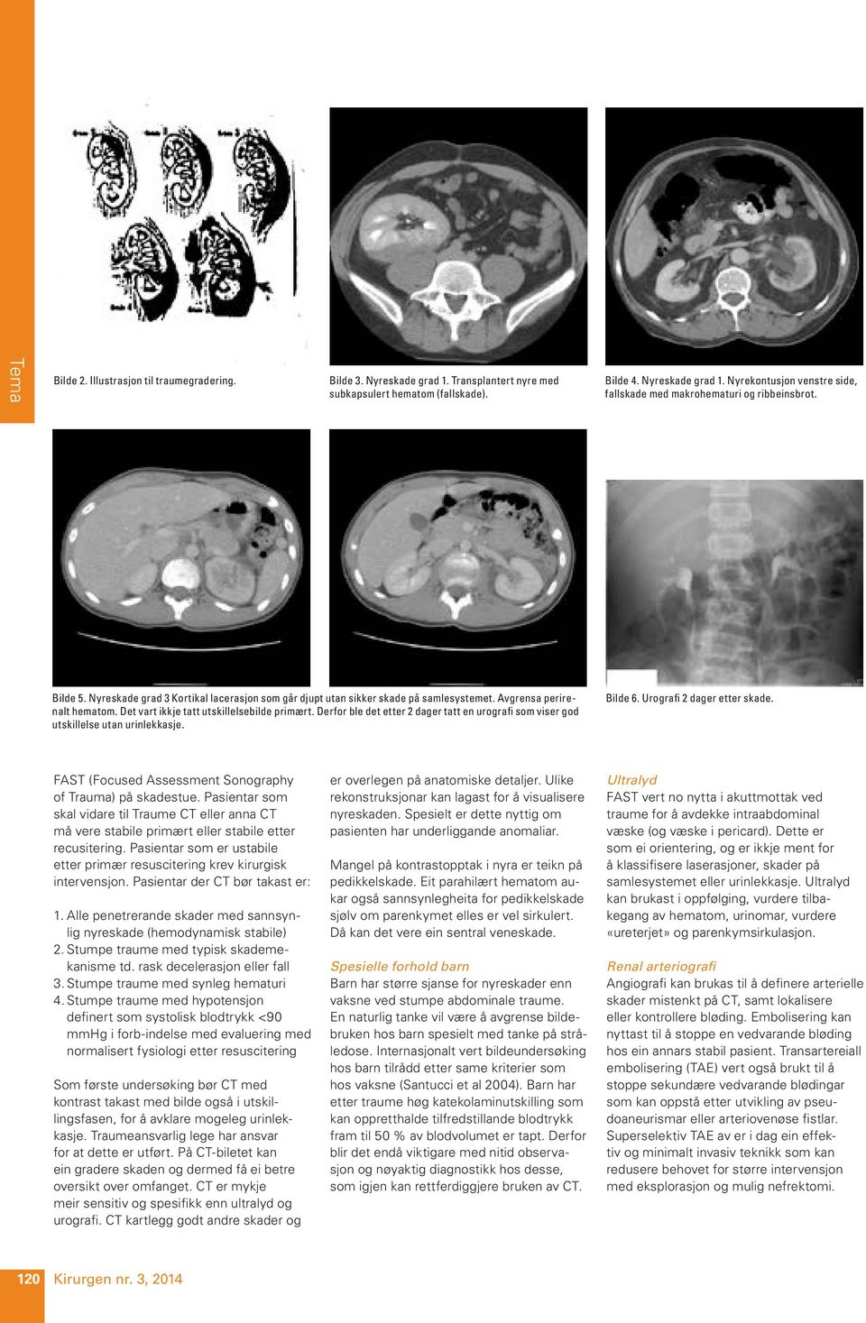 Derfor ble det etter 2 dager tatt en urografi som viser god utskillelse utan urinlekkasje. Bilde 6. Urografi 2 dager etter skade. FAST (Focused Assessment Sonography of Trauma) på skadestue.