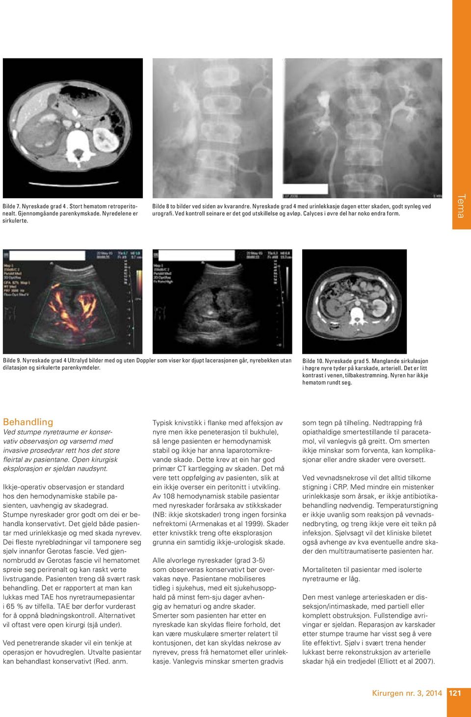 Nyreskade grad 4 Ultralyd bilder med og uten Doppler som viser kor djupt lacerasjonen går, nyrebekken utan dilatasjon og sirkulerte parenkymdeler. Bilde 10. Nyreskade grad 5.