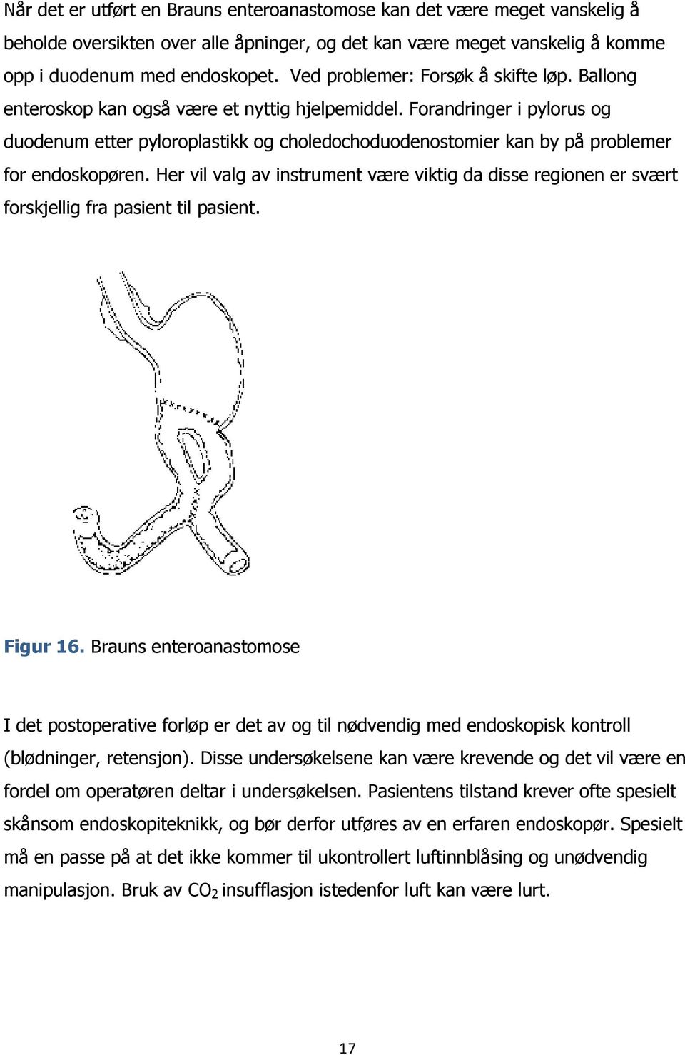 Forandringer i pylorus og duodenum etter pyloroplastikk og choledochoduodenostomier kan by på problemer for endoskopøren.