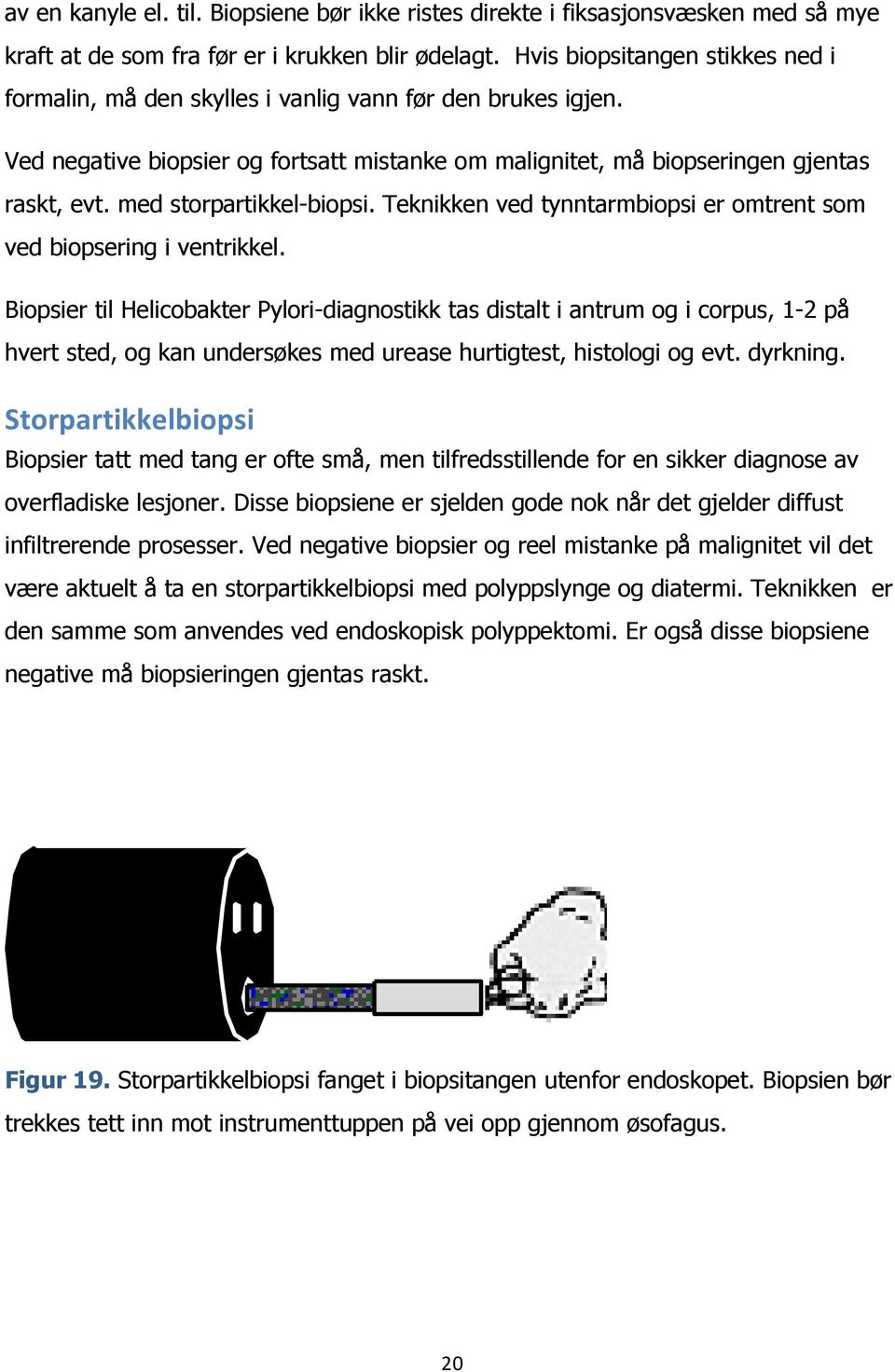 med storpartikkel-biopsi. Teknikken ved tynntarmbiopsi er omtrent som ved biopsering i ventrikkel.