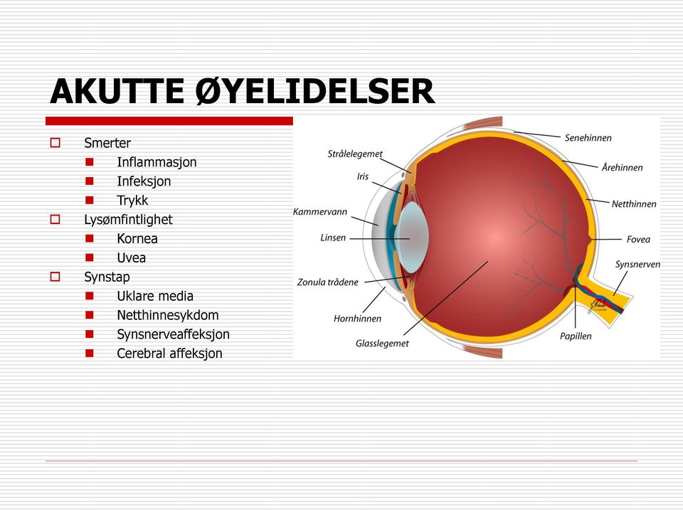 Uvea Synstap Uklare media