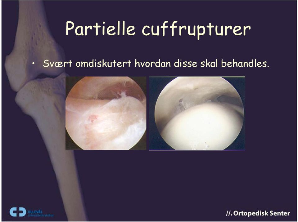 Svært omdiskutert