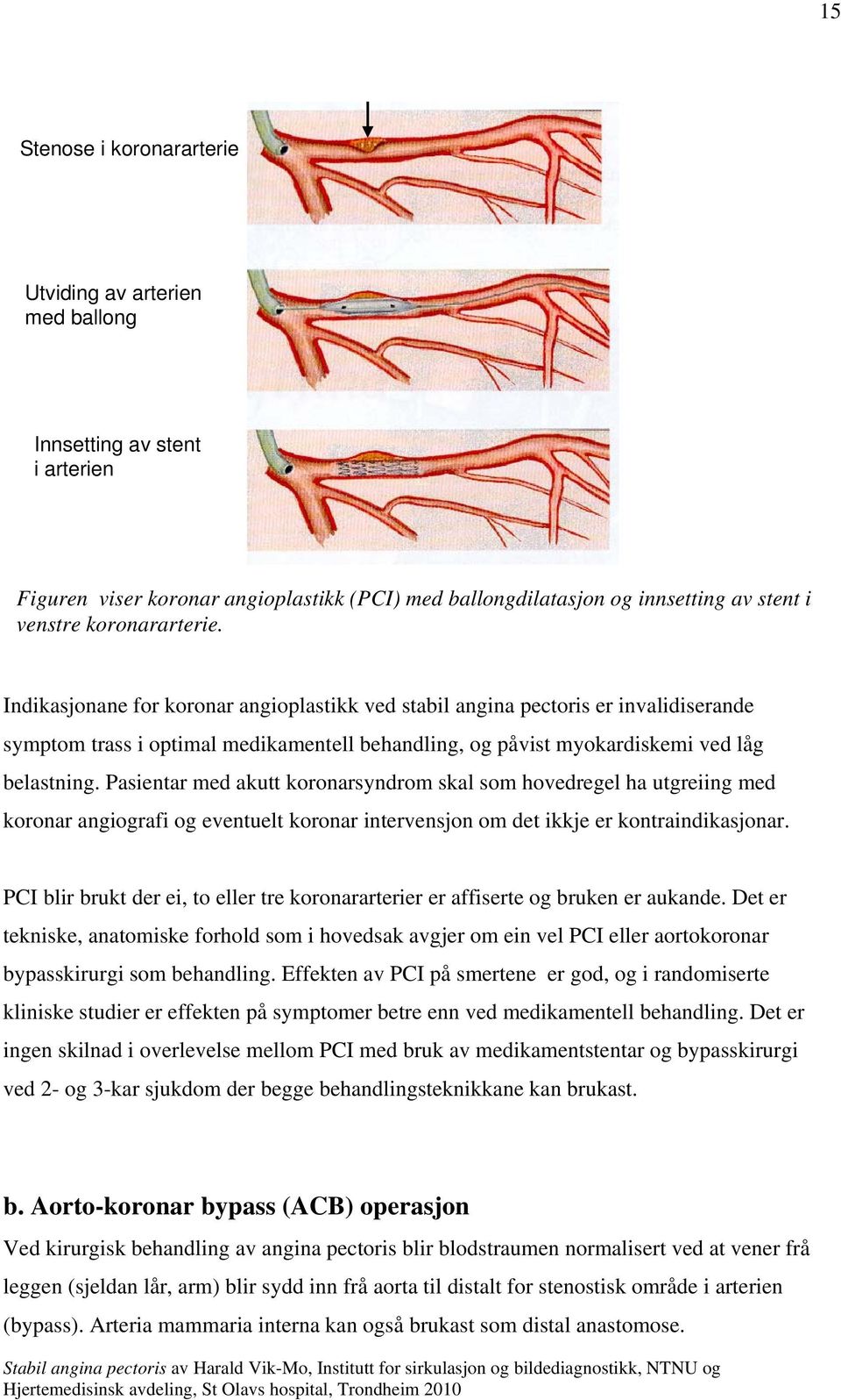 Pasientar med akutt koronarsyndrom skal som hovedregel ha utgreiing med koronar angiografi og eventuelt koronar intervensjon om det ikkje er kontraindikasjonar.