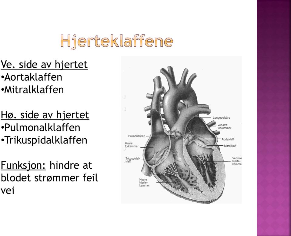 side av hjertet Pulmonalklaffen