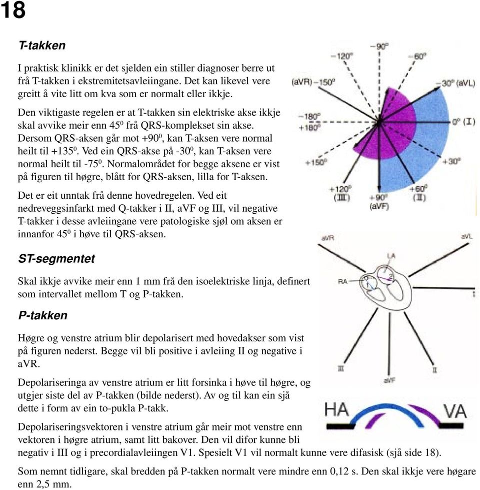 Ved ein QRS-akse på -30 0, kan T-aksen vere normal heilt til -75 0. Normalområdet for begge aksene er vist på figuren til høgre, blått for QRS-aksen, lilla for T-aksen.