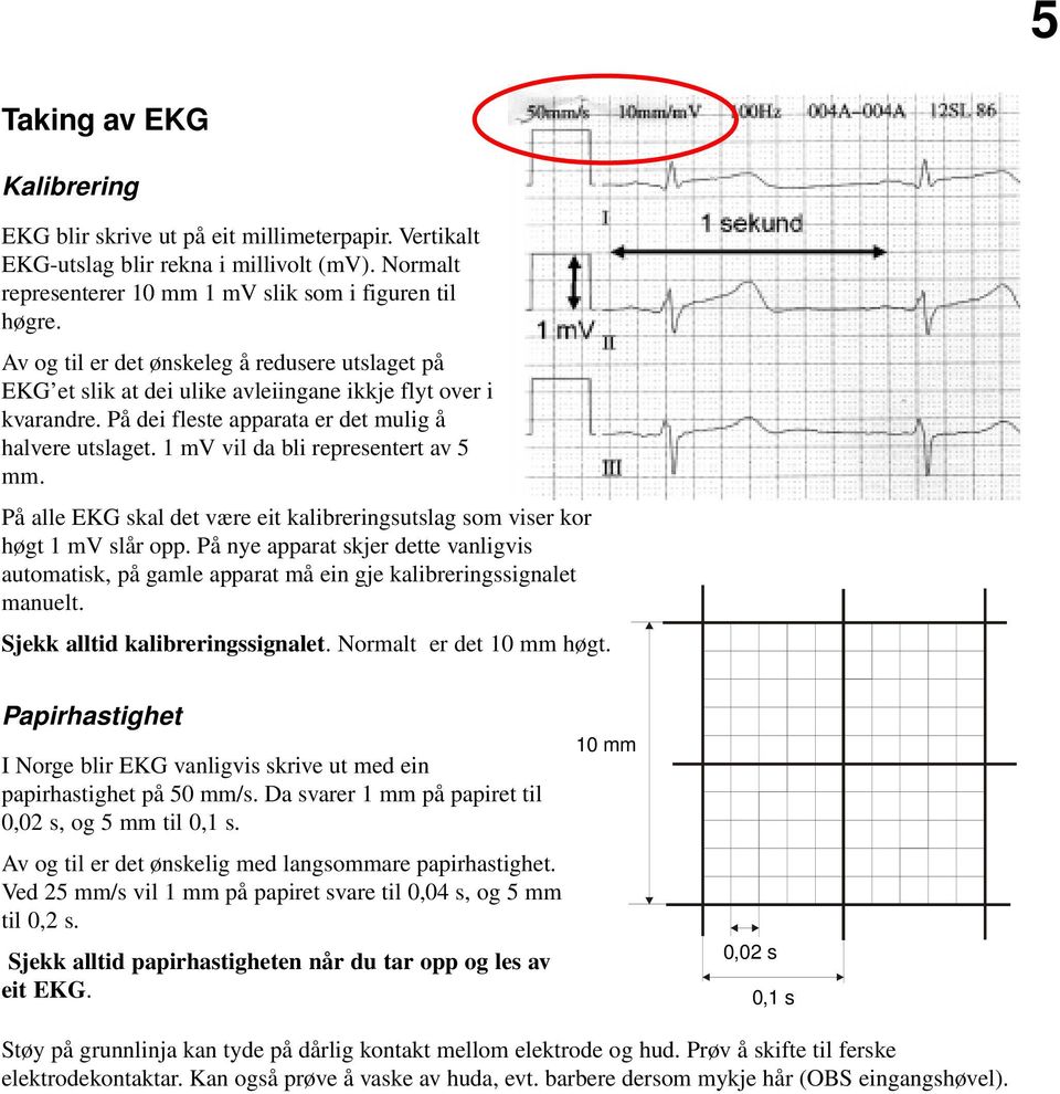 1 mv vil da bli representert av 5 mm. På alle EKG skal det være eit kalibreringsutslag som viser kor høgt 1 mv slår opp.