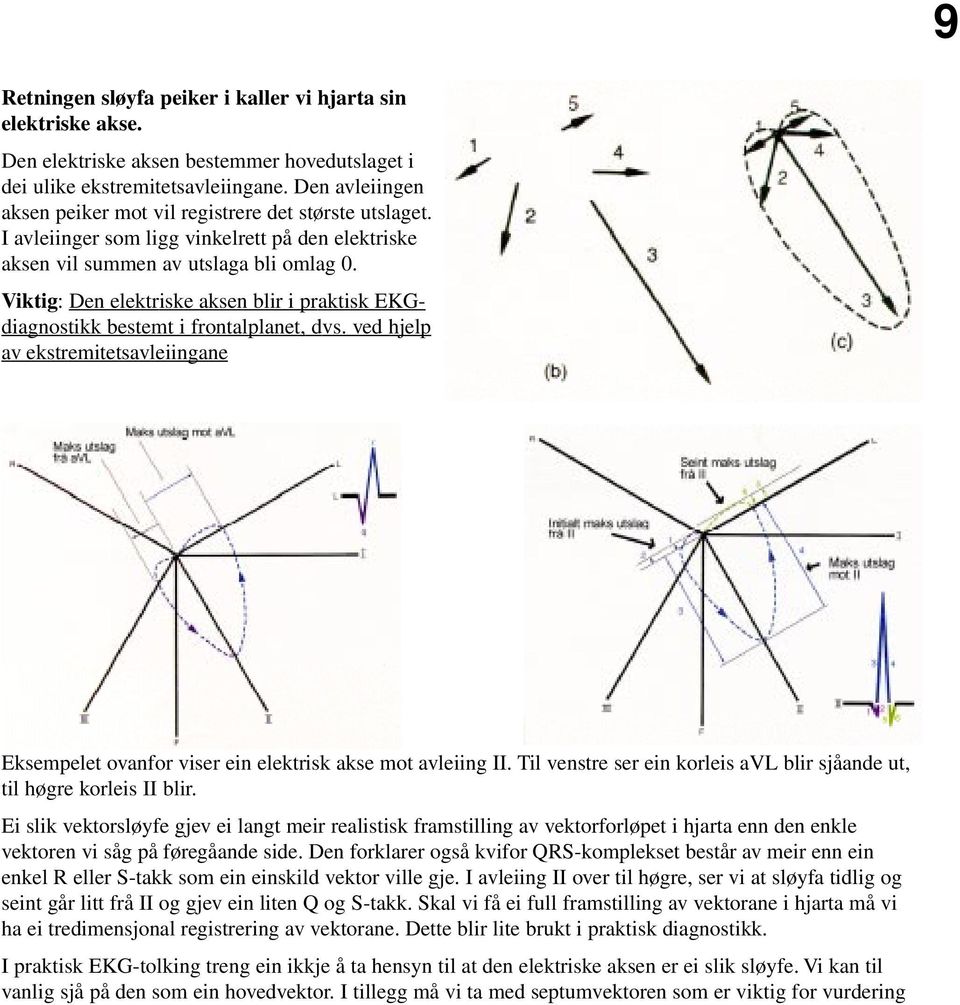 Viktig: Den elektriske aksen blir i praktisk EKGdiagnostikk bestemt i frontalplanet, dvs. ved hjelp av ekstremitetsavleiingane Eksempelet ovanfor viser ein elektrisk akse mot avleiing II.