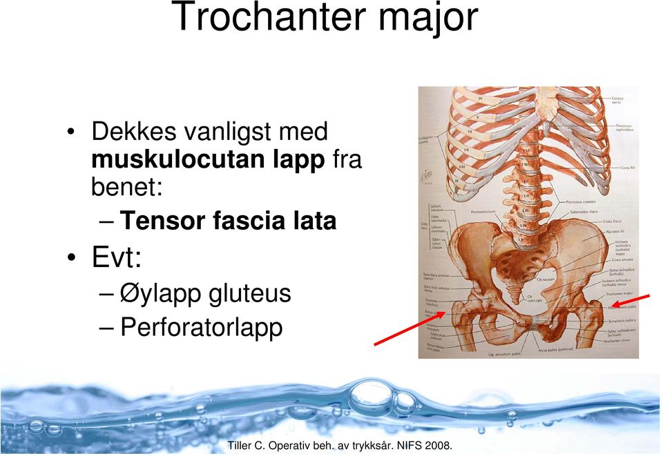 lapp fra benet: Tensor fascia