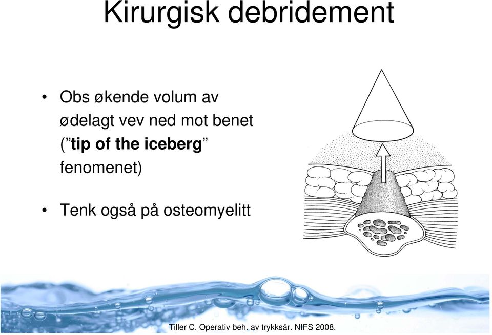 mot benet ( tip of the iceberg