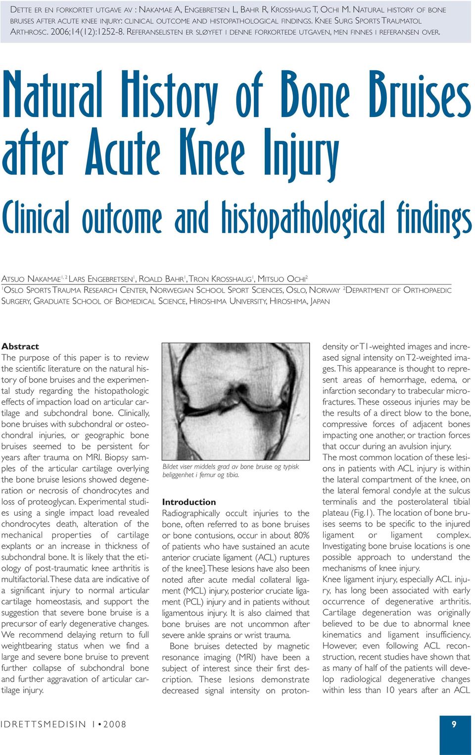 Natural History of Bone Bruises after Acute Knee Injury Clinical outcome and histopathological findings ATSUO NAKAMAE 1, 2 LARS ENGEBRETSEN 1, ROALD BAHR 1, TRON KROSSHAUG 1, MITSUO OCHI 2 1 OSLO
